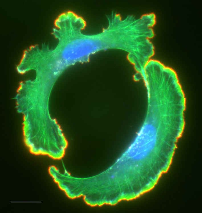 Actin Filaments and Free Filament Ends in a Cancer Cell